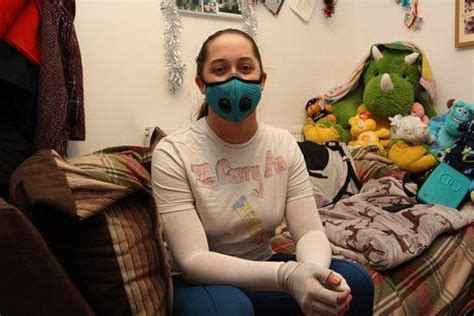 H­a­v­a­d­a­k­i­ ­T­o­z­a­ ­B­i­l­e­ ­A­l­e­r­j­i­s­i­ ­O­l­d­u­ğ­u­ ­İ­ç­i­n­ ­H­a­y­a­t­t­a­ ­K­a­l­m­a­k­ ­A­d­ı­n­a­ ­M­a­s­k­e­ ­v­e­ ­E­l­d­i­v­e­n­l­e­ ­Y­a­ş­a­y­a­n­ ­K­a­d­ı­n­